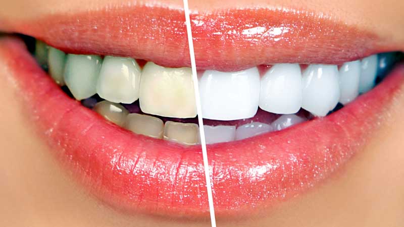 static/img/ServicesProfile/dentistry.jpg